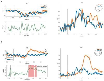Self-processing in coma, unresponsive wakefulness syndrome and minimally conscious state